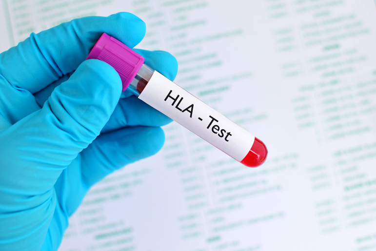 Blood sample for Human Leukocyte Antigen test