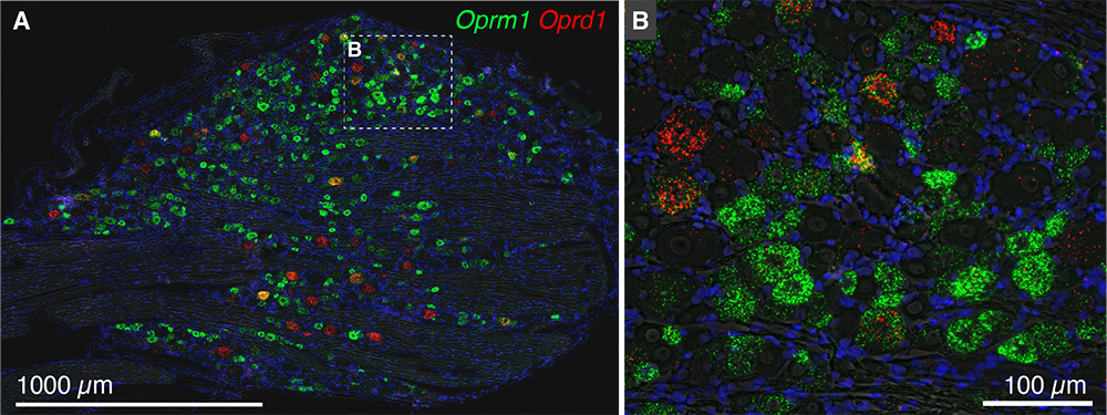 multiplex labeling of sensory neurons