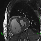 X-Ray images