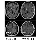 brain scans