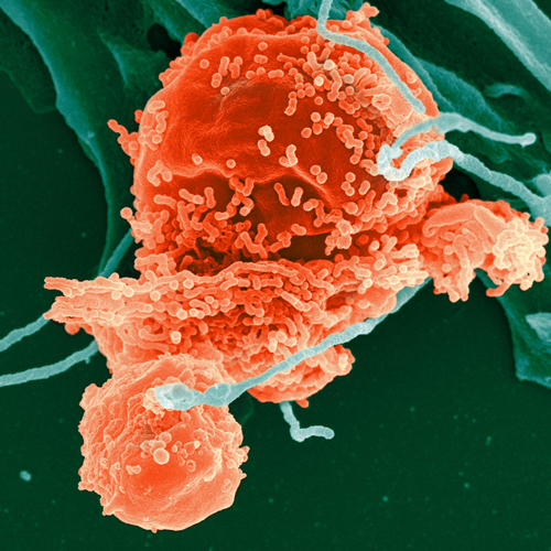 CD40 Expression by B cells