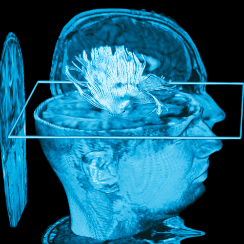 3d image of head and brain cross-section