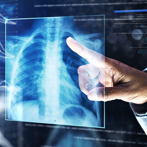 finger pointing to an x-ray