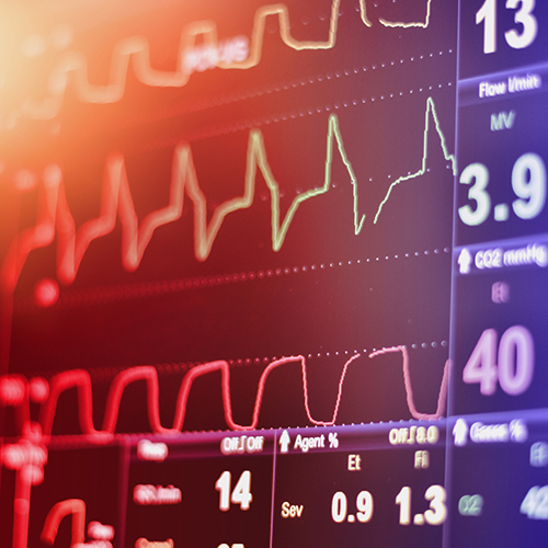 photos of a heart scan reading