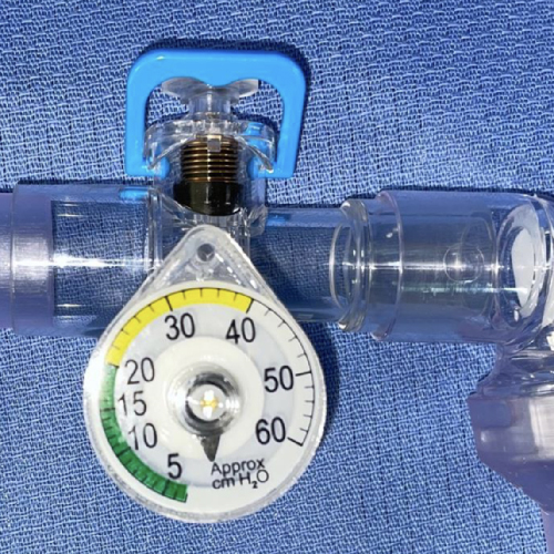 ventilator attachment