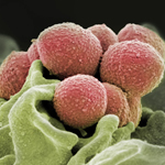 Streptococcus pyogenes (group A strep) depicting the normal immune response of a neutrophil engulfing the bacterial invader