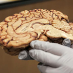 A human brain that was donated to NIH's Human Brain Collection Core