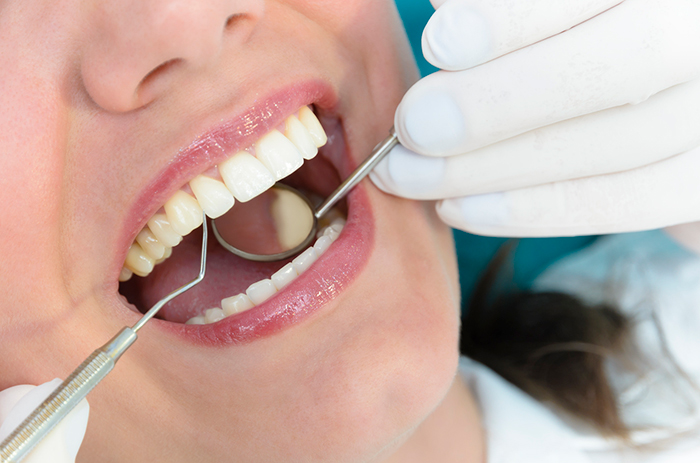 A person opening their mouth while a dentist looks inside with tools