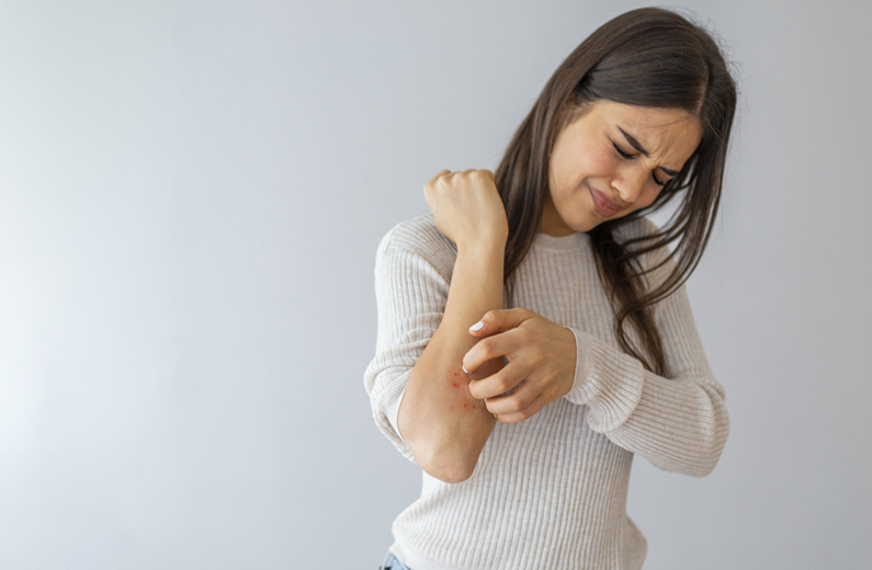 woman scratching forearm