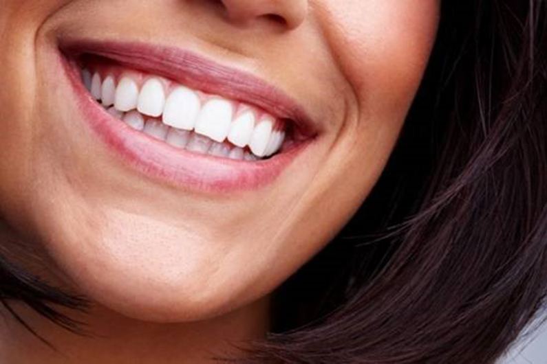 Close-up of a woman's teeth