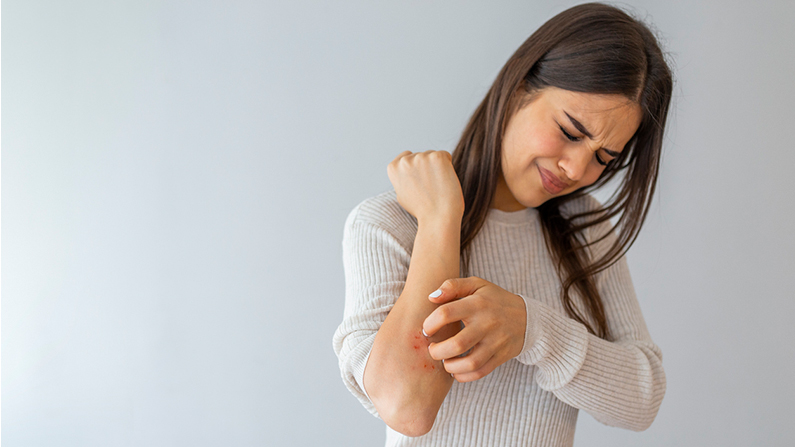 woman scratching skin with psoriasis