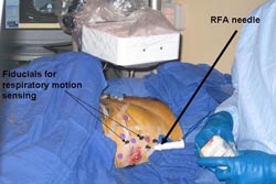 Procedure space for minimally invasive, image-guided therapy