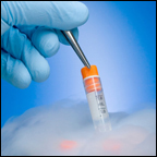 cryopreservation