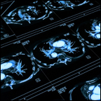 targeted early chest CT