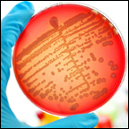 bacterial culture