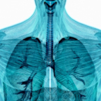 chest x-ray