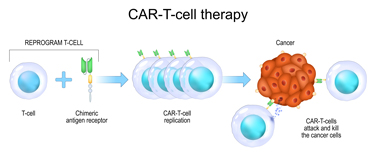 CAR-T-cell therapy illustrated medical flowchart
