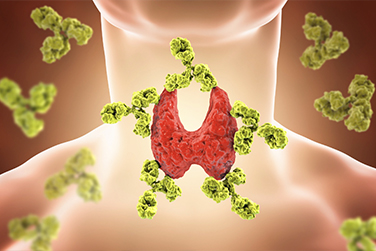 Medical illustration depicting a thyroid