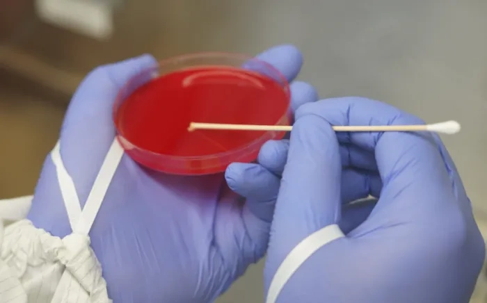 A laboratory technician wearing gloves holds a red agar plate in one hand and a cotton swab in the other, preparing for a microbiological test.