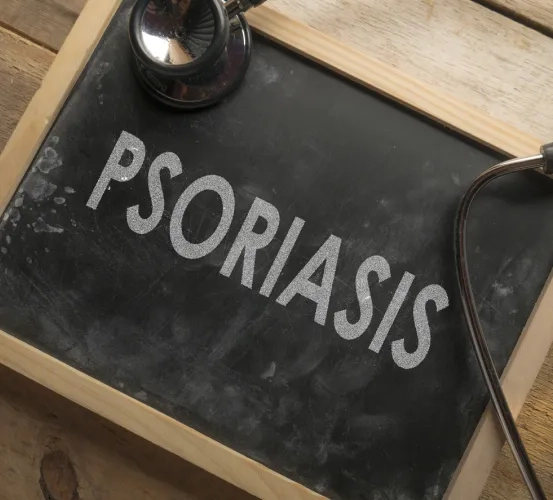 Pilot Study to Evaluate the Effect of Nicotinamide Riboside on Immune Activation in Psoriasis